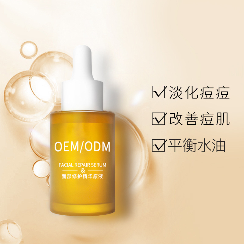 益阳市_祛痘精华原液OEM